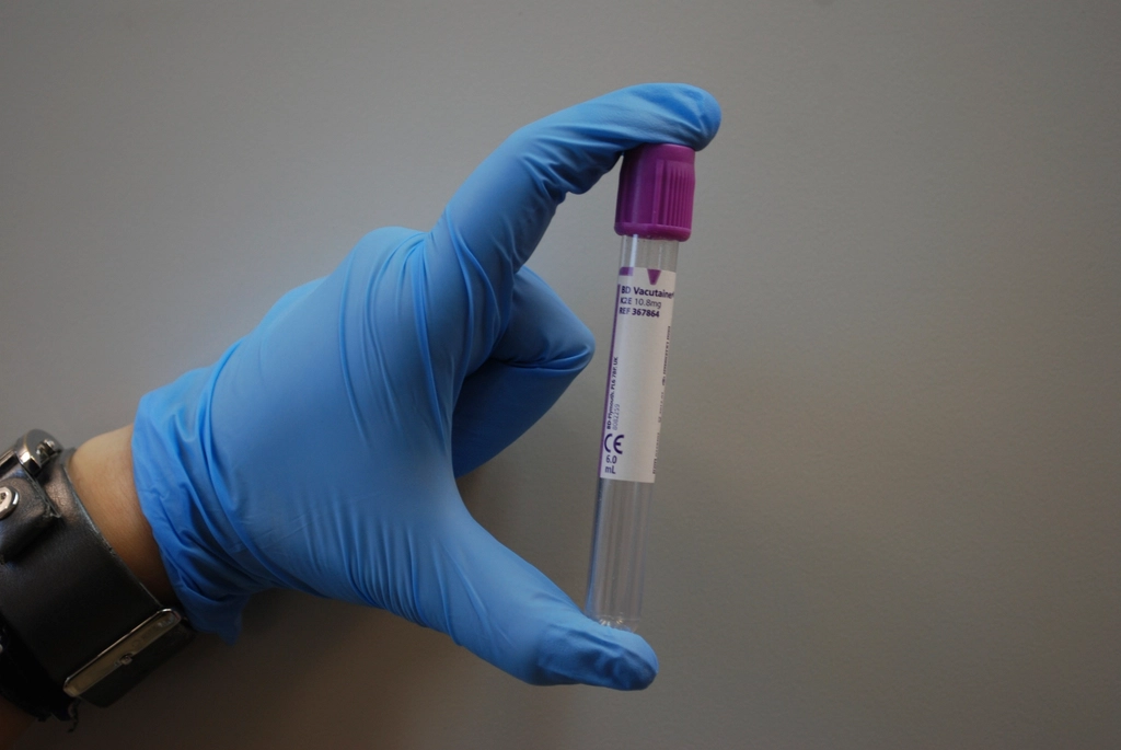 Blood test tube, representing thyroid medication review